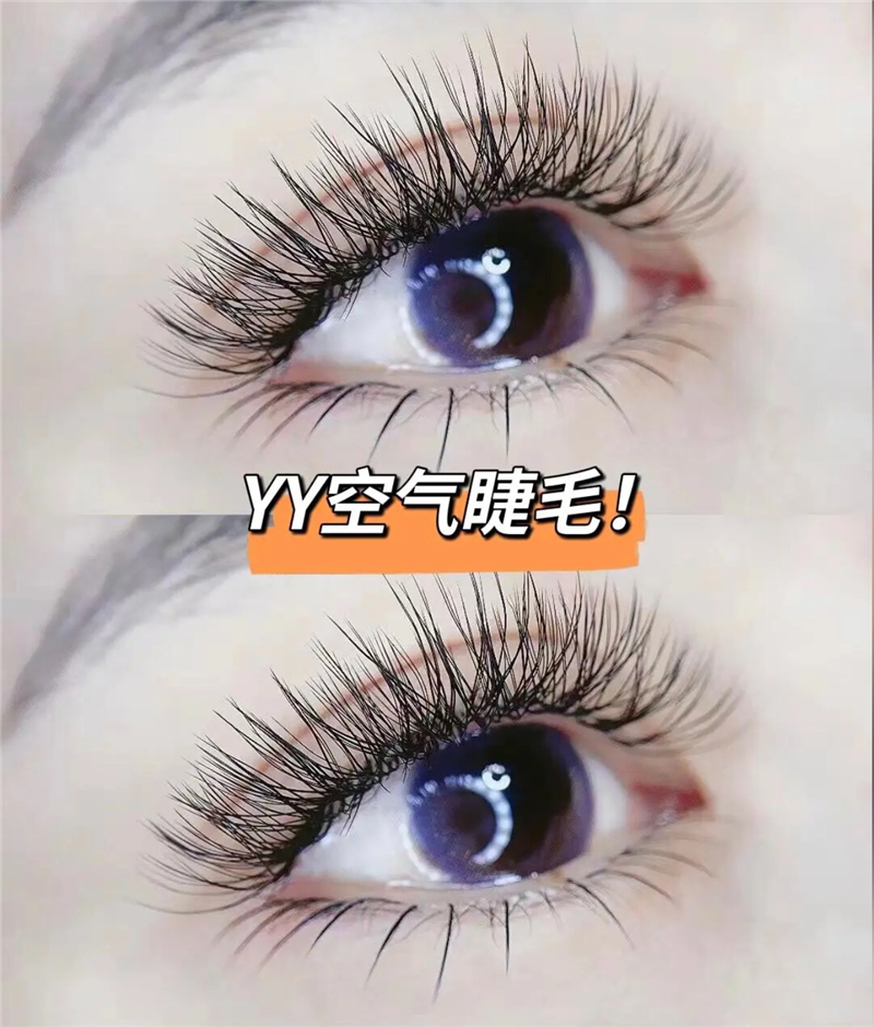 YY